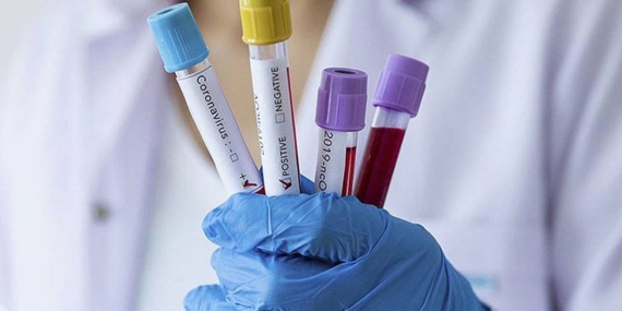 TTB’DEN SALGIN UYARISI: “BU YIL GRİP DAHA AĞIR GEÇECEK”